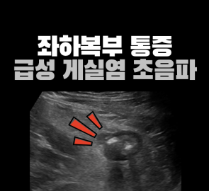 왼쪽 아랫배 급성 게실염 초음파 영상이 들어간 원본 표지
