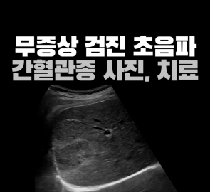 무증상 검진 초음파에서 발견한 간혈관종 주제의 원본 표지