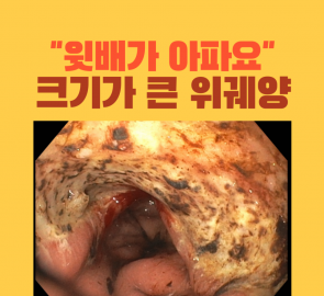 넓고 깊은 위궤양 내시경 사진이 들어간 원본 표지
