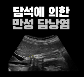 담석에 의한 만성 담낭염 초음파 영상이 들어간 원본 표지
