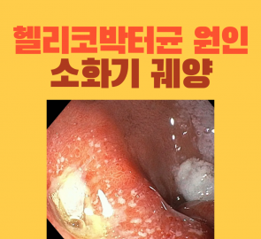 십이지장궤양 내시경 사진을 넣은 원본 표지