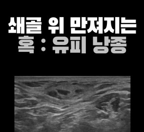 우측 쇄골 위 혹과 경부 초음파 영상을 함께 보여주는 원본 표지