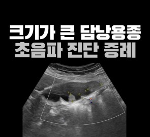 검진 중 발견한 담낭용종 초음파 사진이 들어간 원본 표지