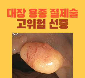큰 대장 용종 내시경 사진을 넣은 원본 표지