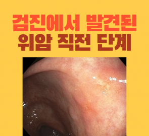 검진 중 발견한 위 선종의 내시경 사진을 담은 원본 표지